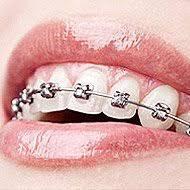 Tips to find an orthodontic consultation All those who are in looking forward for dental treatment must have proper information that can help them make best decisions in terms of orthodontic care.