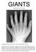 GIANTS. Compiled by: David A. Sargent. 6 Fingers Traits Found On Giants As Well As Double Sets of Teeth